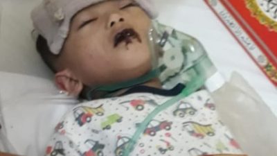 Diduga Karena Terlamabat Pelayanan Medis “Bocah 1 Tahun Meninggal Dunia”